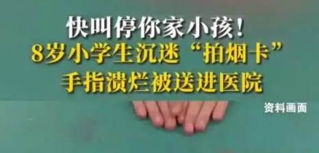快叫停！8岁小学生沉迷拍烟卡手指溃烂